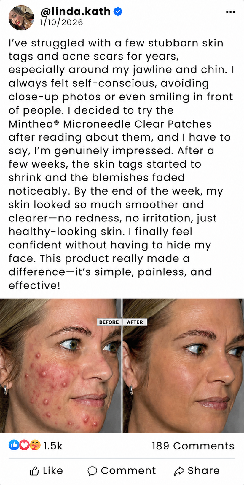 Linda Kath before and after results