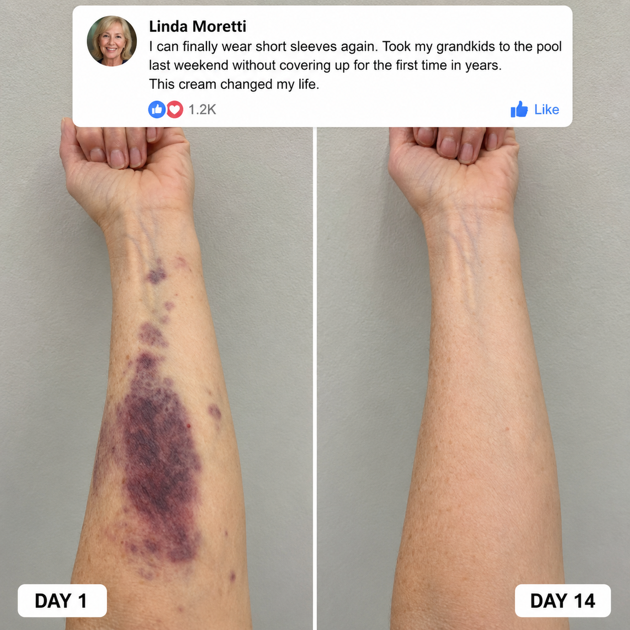 Minthea™ Bruise Repair & Skin — Strengthening Cream