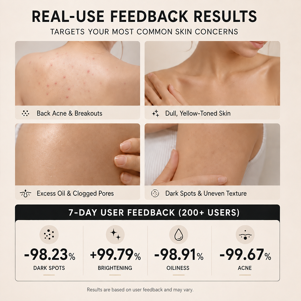 🛀🏻Niacinamide Skin Brightening Soap melasma dark spots freckle