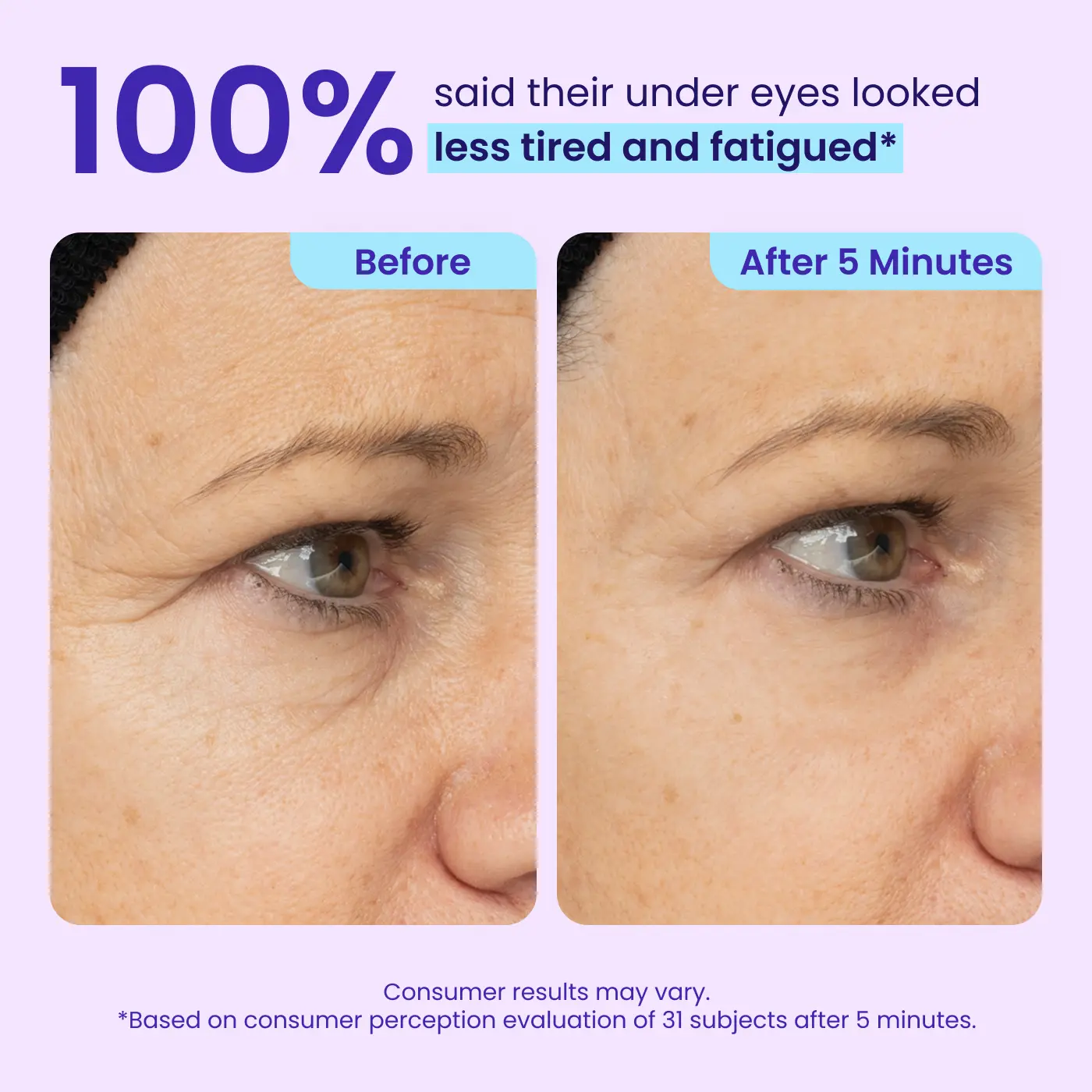 Minthea™ Eye Bag Instant Eraser, Tightens, Firms, & Blurs Wrinkles