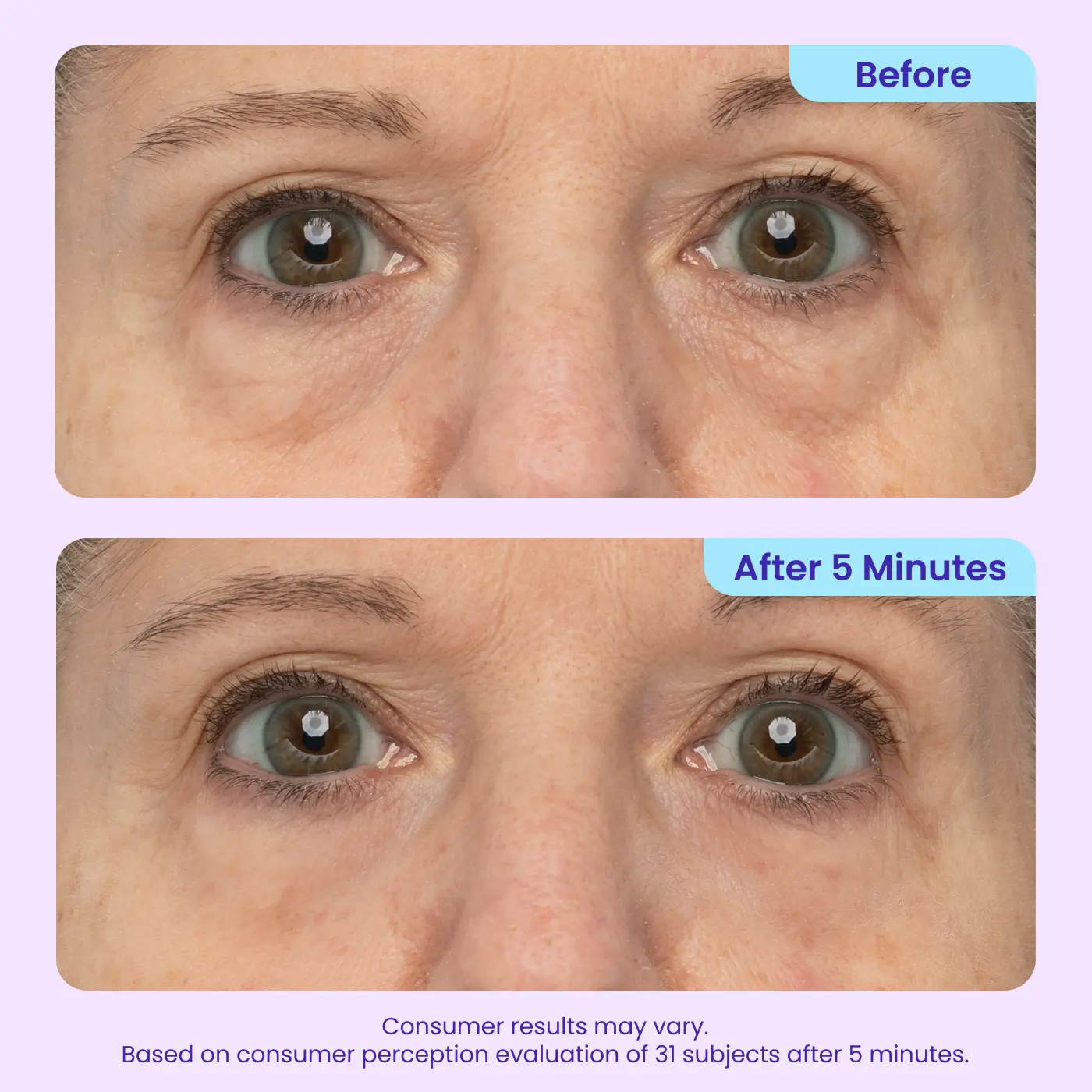 Minthea™ Eye Bag Instant Eraser, Tightens, Firms, & Blurs Wrinkles