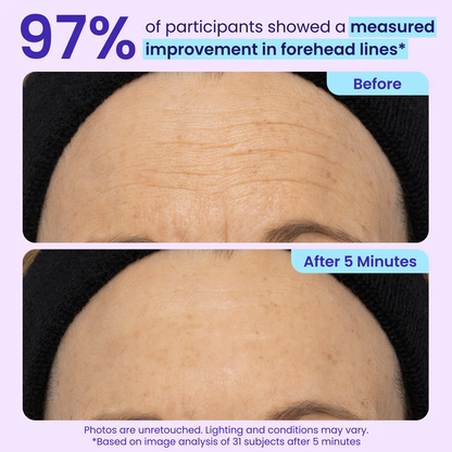 Minthea™ Eye Bag Instant Eraser, Tightens, Firms, & Blurs Wrinkles