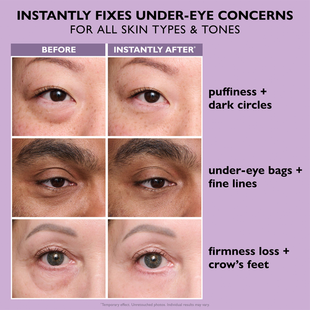Minthea™ Eye Bag Instant Eraser, Tightens, Firms, & Blurs Wrinkles